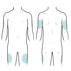 Different locations for shot, including back of upper arms and front of thighs. 