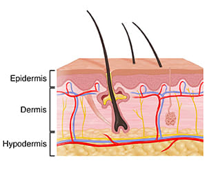 Cross section of skin showing epidermis, dermis, and hypodermis.
