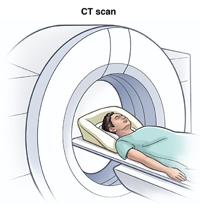 Person lying on table, with head entering donut-shaped opening for CT machine for a CT scan.