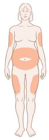 Insulin injection sites on front of body.