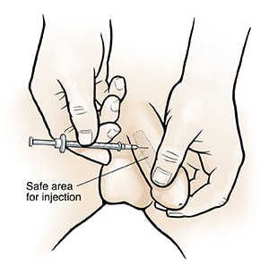 Man injecting medicine into penis.