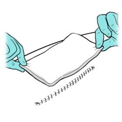 Gloved hands holding gauze from opposite corners and placing it on top of incision.