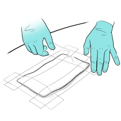 Gloved hands taping each side of gauze to skin.