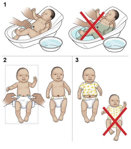 Three steps in caring for a newborn's umbilical cord.