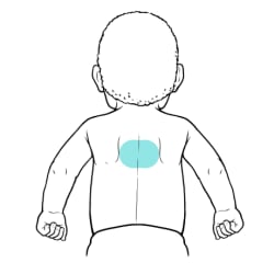Baby’s back with area between shoulder blades highlighted.